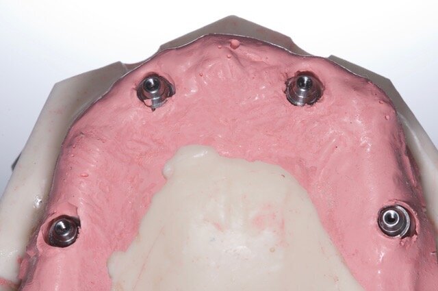 Fig. 29
