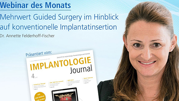 Webinar: Mehrwert von Guided Surgery