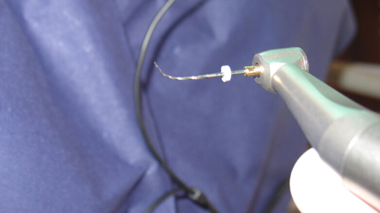 Endodontic follow-up in strongly curved root canals