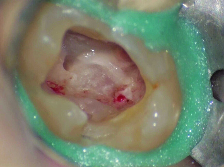 Figure 17