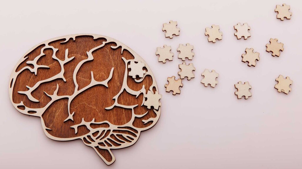 Verbindung zwischen Parodontitis und Amyloid-Plaques