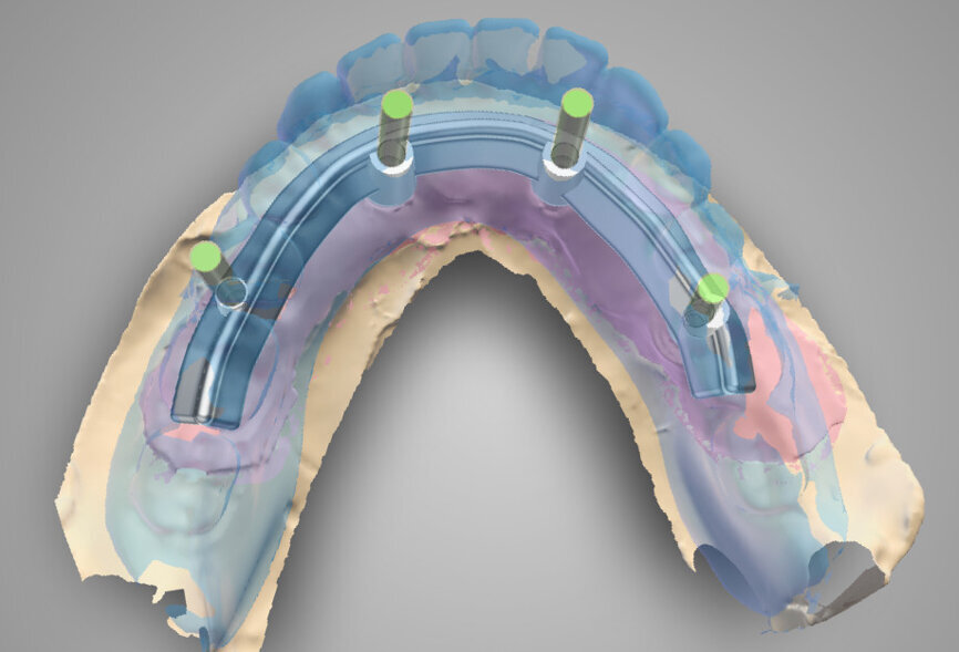 Fig. 30