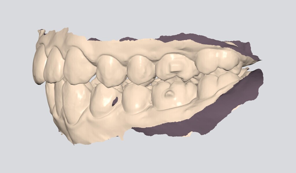 Fig. 18