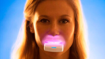 La PBM, terapia intra-orale di fotobiomodulazione potrebbe ridurre il tempo di trattamento ortodontico