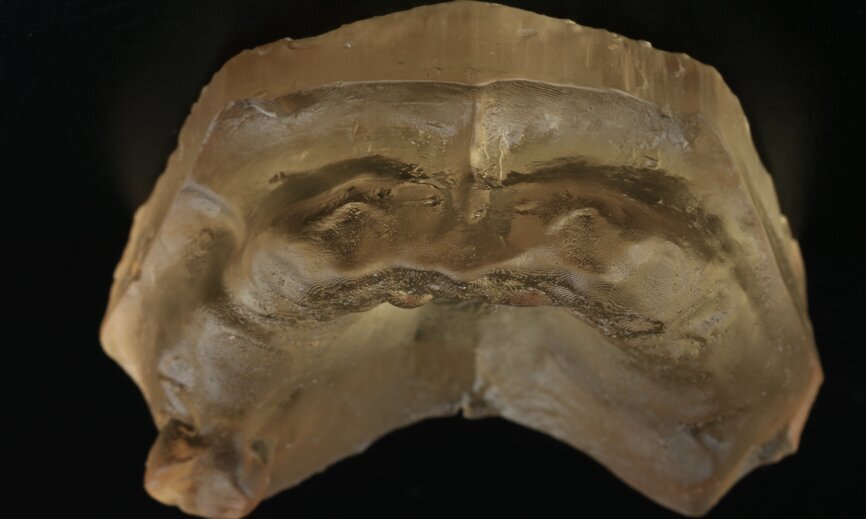 Fig. 18