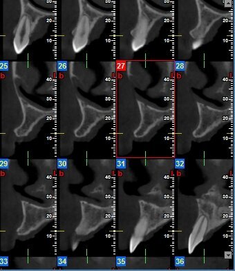 Fig. 1b