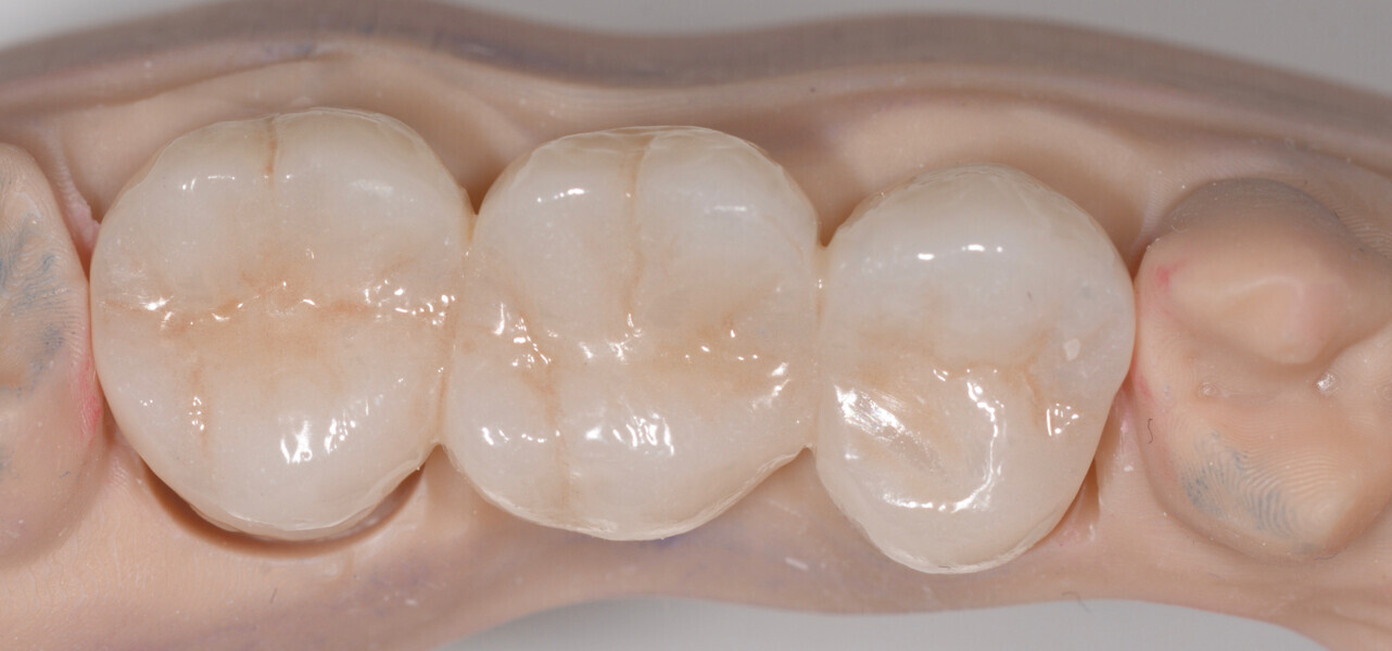 Fig. 4b