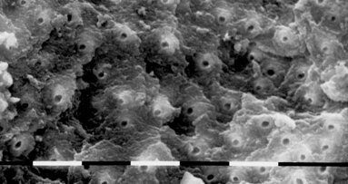 Laser in endodontics (Part II)
