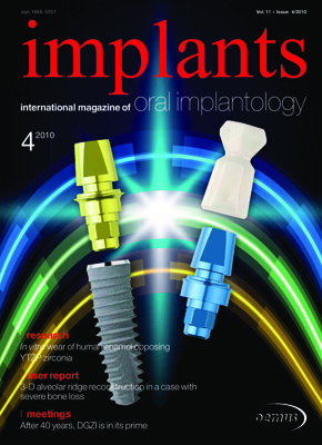 implants international