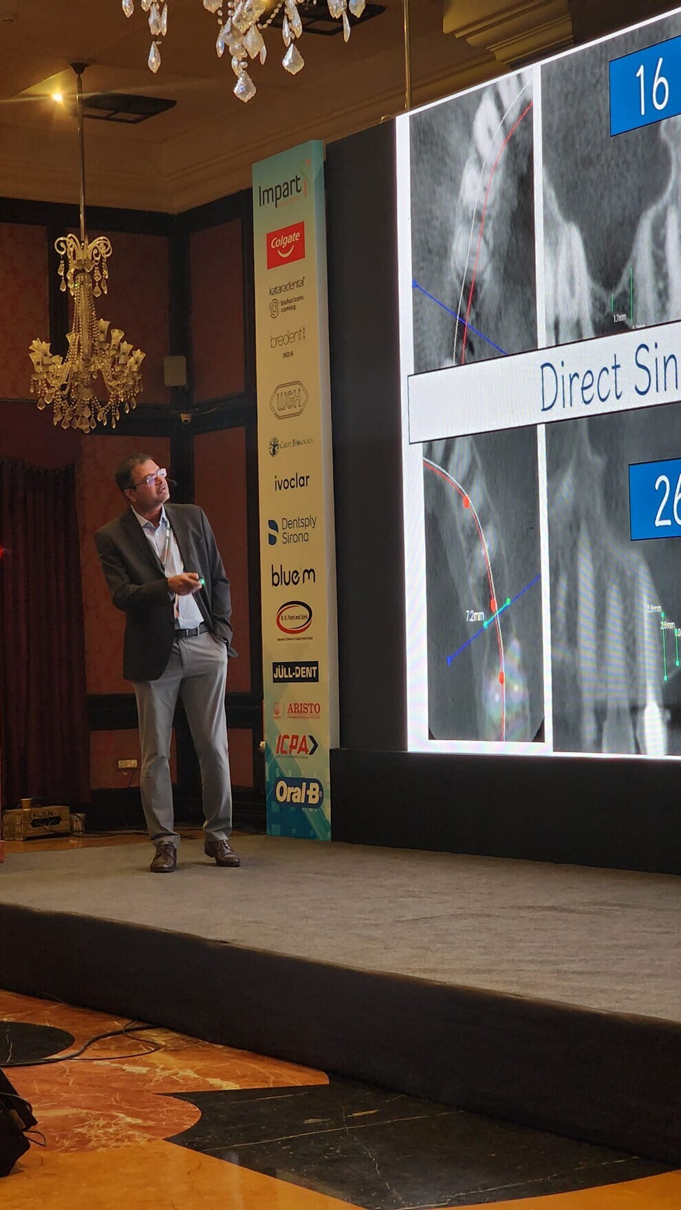 Sudhindra Kulkarni covering posterior maxilla