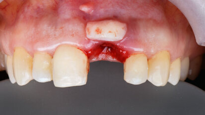 “We can look forward to decisive progress in soft-tissue regeneration in the coming years”
