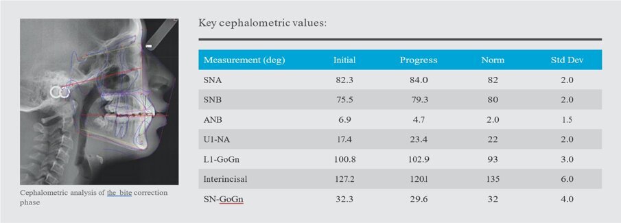 Cephalometric analysis of the bite correction phase