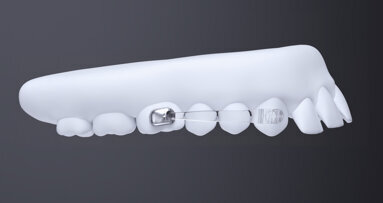 Solving sagittal discrepancies in orthodontics is probably the most energy-demanding movement you can do with aligners