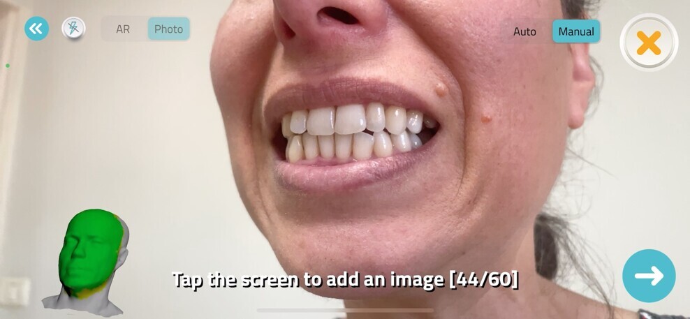 Fig. 6: User-friendly interface, providing real-time coverage of the scanning process.