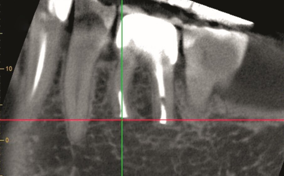 … and sagittal views (n).