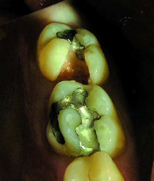 Figure 12