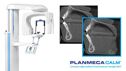 Eccezionale qualità di imaging con le unità CBCT di Planmeca