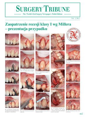 Surgery Tribune Poland No. 1, 2015