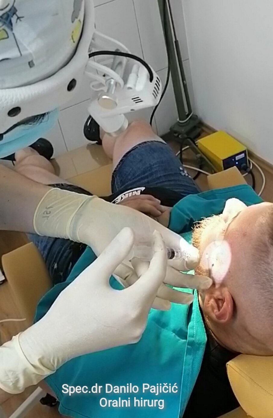 vođenje spinalne igle sa graničnikom