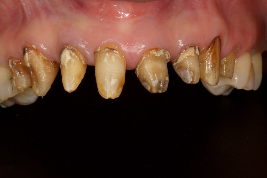 Fig. 4