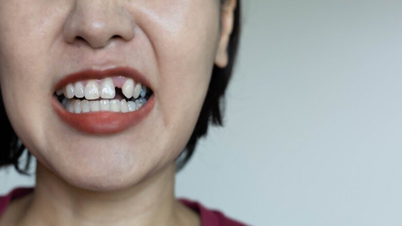 El control deficiente de la glucemia y la pérdida de dientes