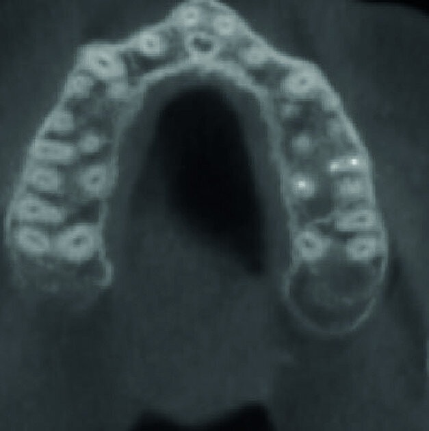 Fig.: 3