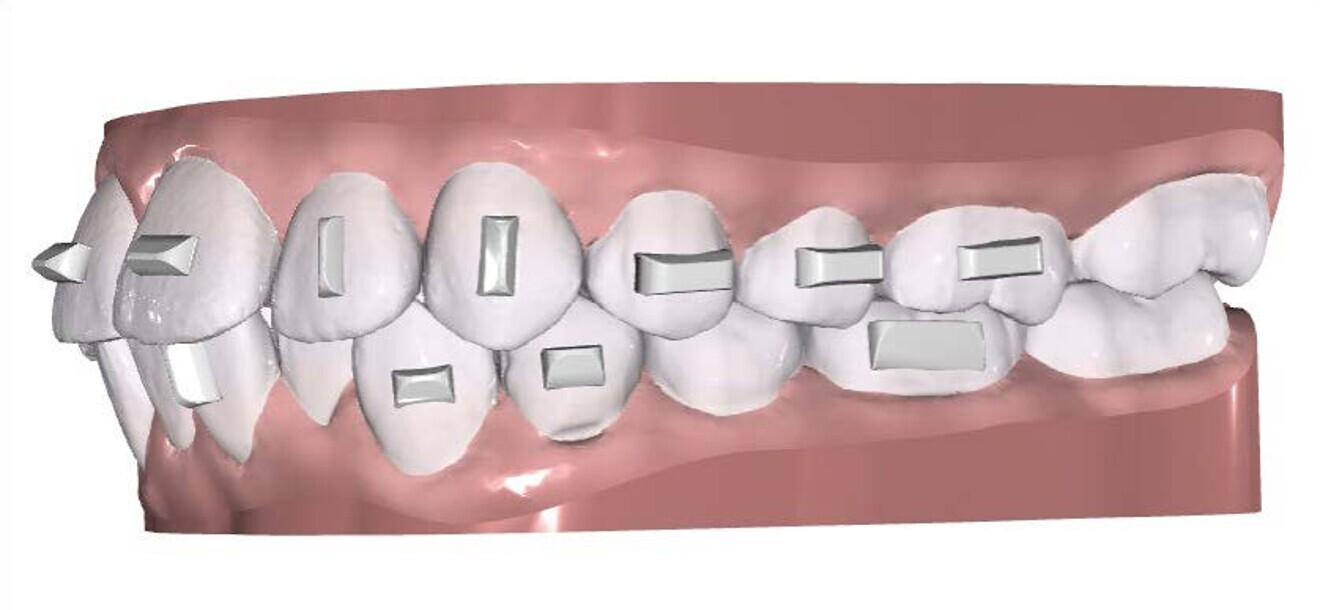 Fig. 3b