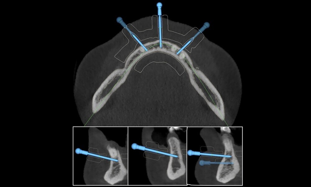 Fig. 21
