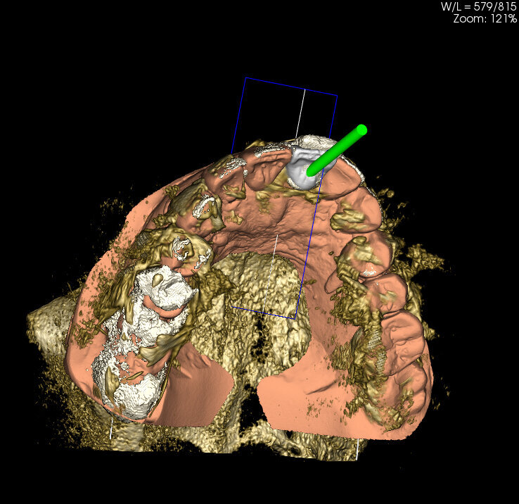 Fig. 11a