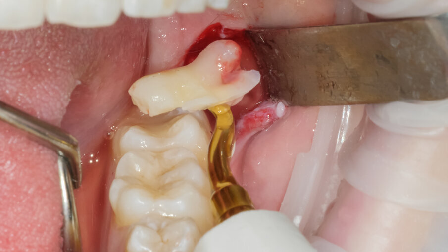 Fig. 6