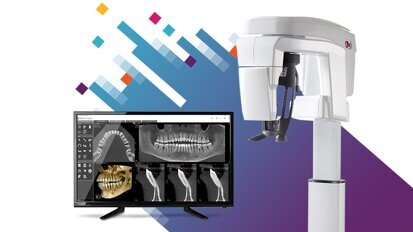 La Neo Edition della famiglia CS 8200 3D rende il sistema CBCT ancora più intuitivo