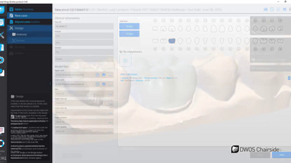 Dental Wings - DWOS CAD_CAM Design Software Integrates vhf camfacture Z4 mill
