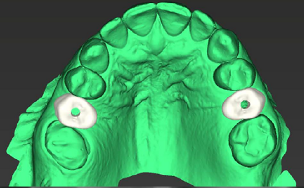 Fig. 5b