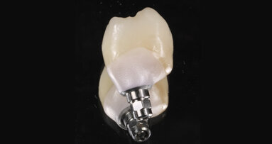 The material of the future for all kinds of indications