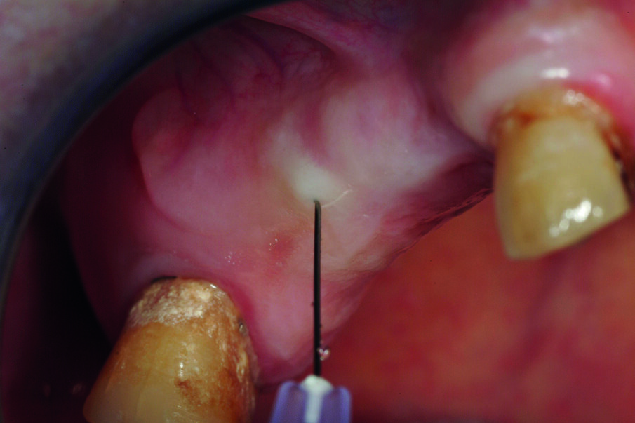 Fig. 3a