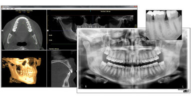 Danaher acquires PaloDEx