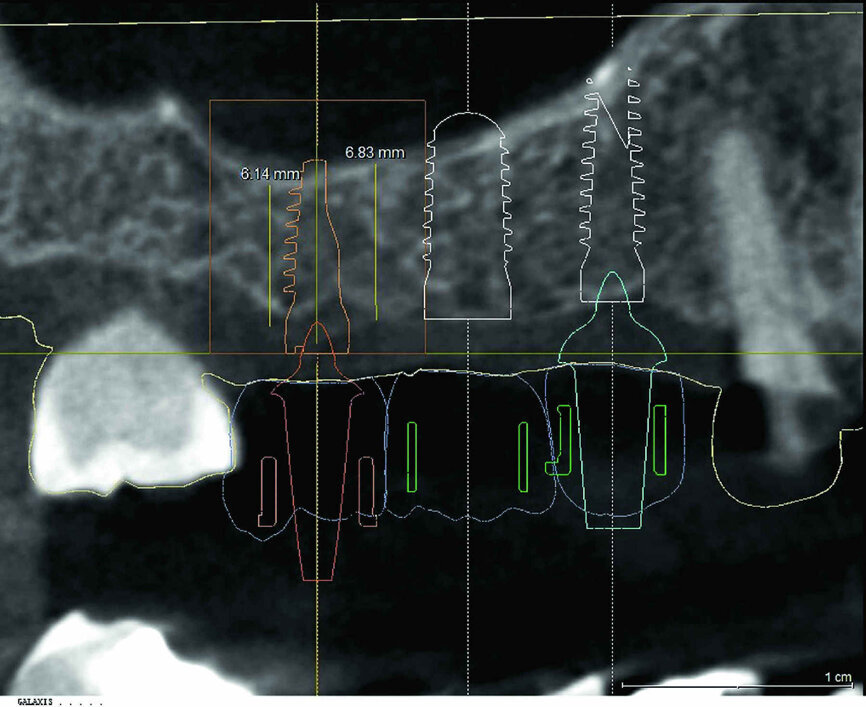 Fig. 4 : Visualisation de la planification. 