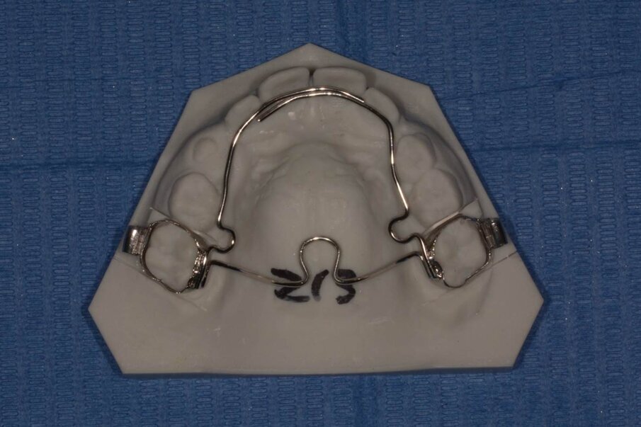 Figg. 2a-2c - Esempio di modello di lavoro ortodontico ottenuto da file .stl.
