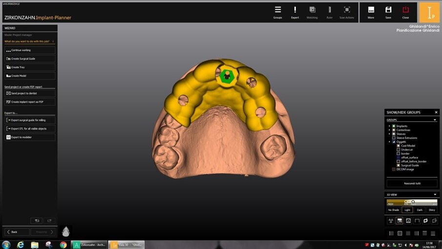 Fig. 11c