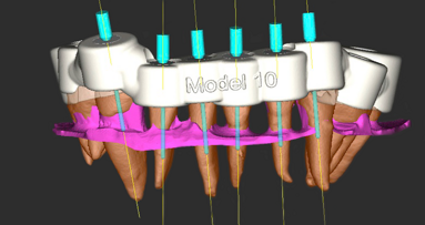 Research team receive multiple awards for micro-guided endodontics technique