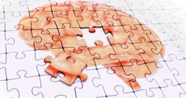 El tratamiento periodontal es beneficioso en el Alzheimer