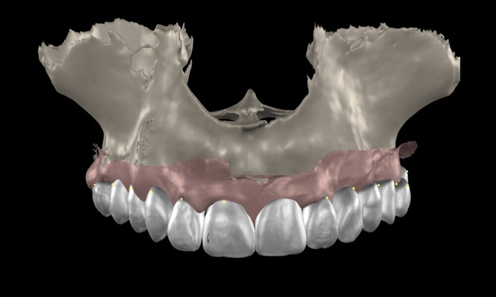 Fig. 15