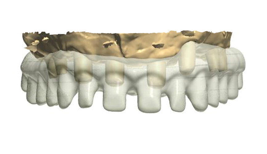 Fig. 2: Design of the construction with the transparency mode on.