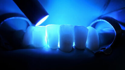 Researchers use AI to predict dental composite performance