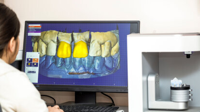 Interview on evaluating the costs of adding 3D&nbsp;printing to the dental practice