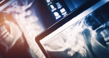Dangerous X-ray radiation: German authorities caution Asian IDS exhibitors