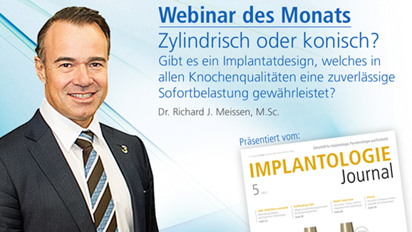 Live-Webinar: Zylindrisch oder konisch?