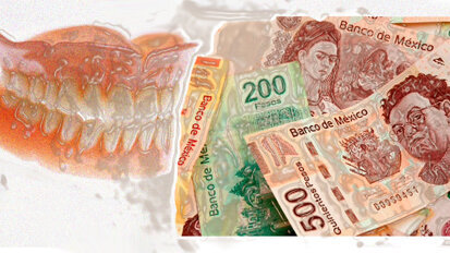 ¿Cobrar o no cobrar? Esa es la cuestión