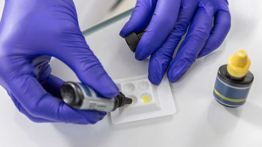Estudo compara a capacidade de penetração de selantes na dentina e métodos de obturação