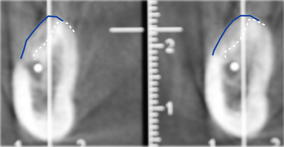 Fig. 13